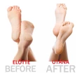 Pedi Twist / SPIN PRO AKKUS BŐRKEMÉNYEDÉS ELTÁVOLÍTÓ SAROKRESZELŐ PEDIKŰR MANIKŰR